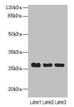 Western blot. All lanes: C10orf82 antibody at 1µg/ml. Lane 1: A431 whole cell lysate. Lane 2: HepG2 whole cell lysate. Lane 3: Mouse thymus tissue. Secondary. Goat polyclonal to rabbit IgG at 1/10000 dilution. Predicted band size: 27, 18, 13 kDa. Observed band size: 27 kDa
