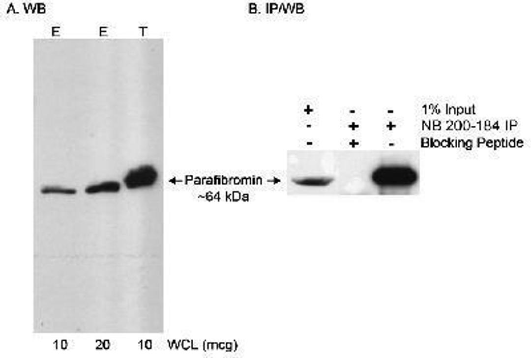 Western Blot: CDC73/HRPT2 Antibody [NB200-184] - Detection of Human Parafibromin on HeLa whole cell lysate using NB200-184. In B, Parafibromin was immunoprecipitated by using NB200-184 at 3 mcg/10mg with or without blocking peptide.