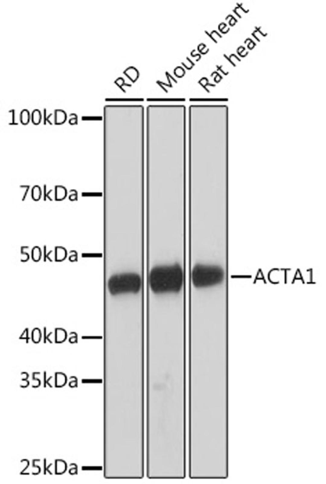 Western blot - ACTA1 Rabbit mAb (A2235)