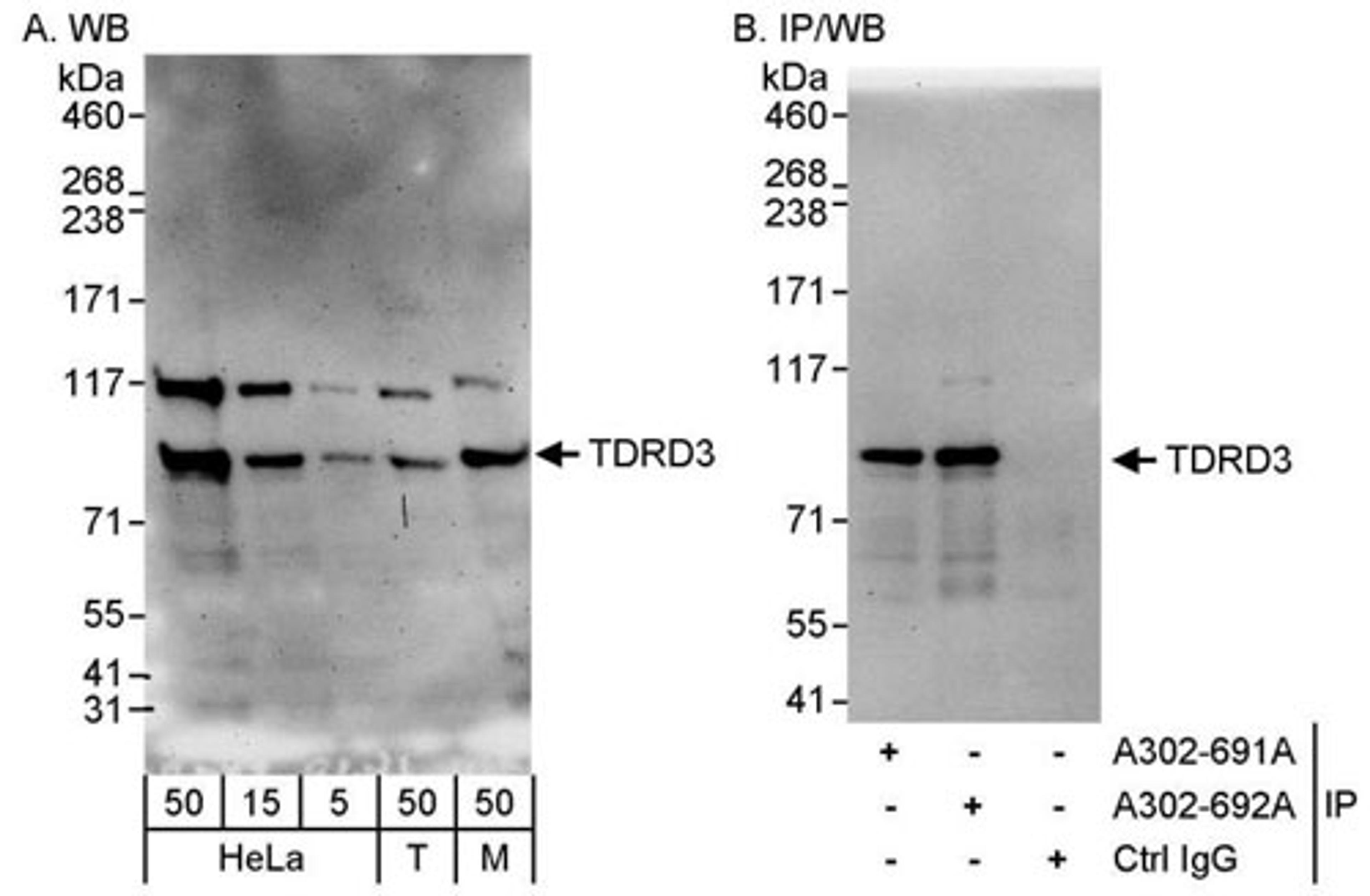 Detection of human and mouse TDRD3 by WB and IP.