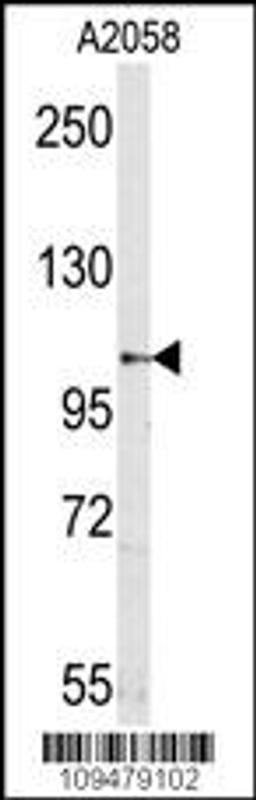 Western blot analysis of mouse anti-Sema5a Pab in A2058 cell line lysates (35ug/lane).