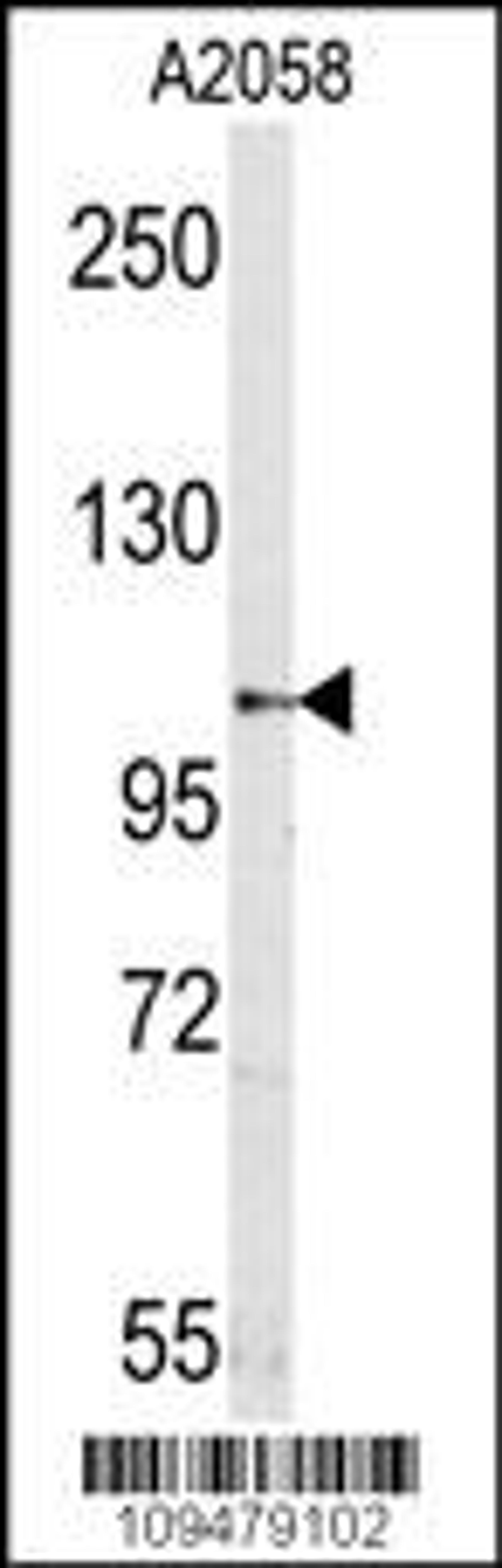 Western blot analysis of mouse anti-Sema5a Pab in A2058 cell line lysates (35ug/lane).