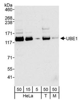 Detection of human and mouse UBE1 by western blot.