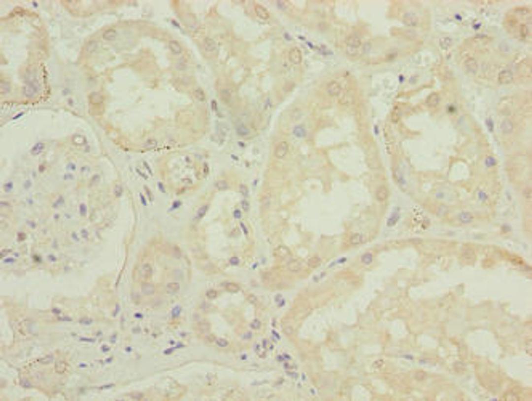 Immunohistochemistry of paraffin-embedded human kidney tissue using CSB-PA752102LA01HU at dilution of 1:100