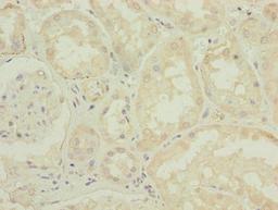 Immunohistochemistry of paraffin-embedded human kidney tissue using CSB-PA752102LA01HU at dilution of 1:100