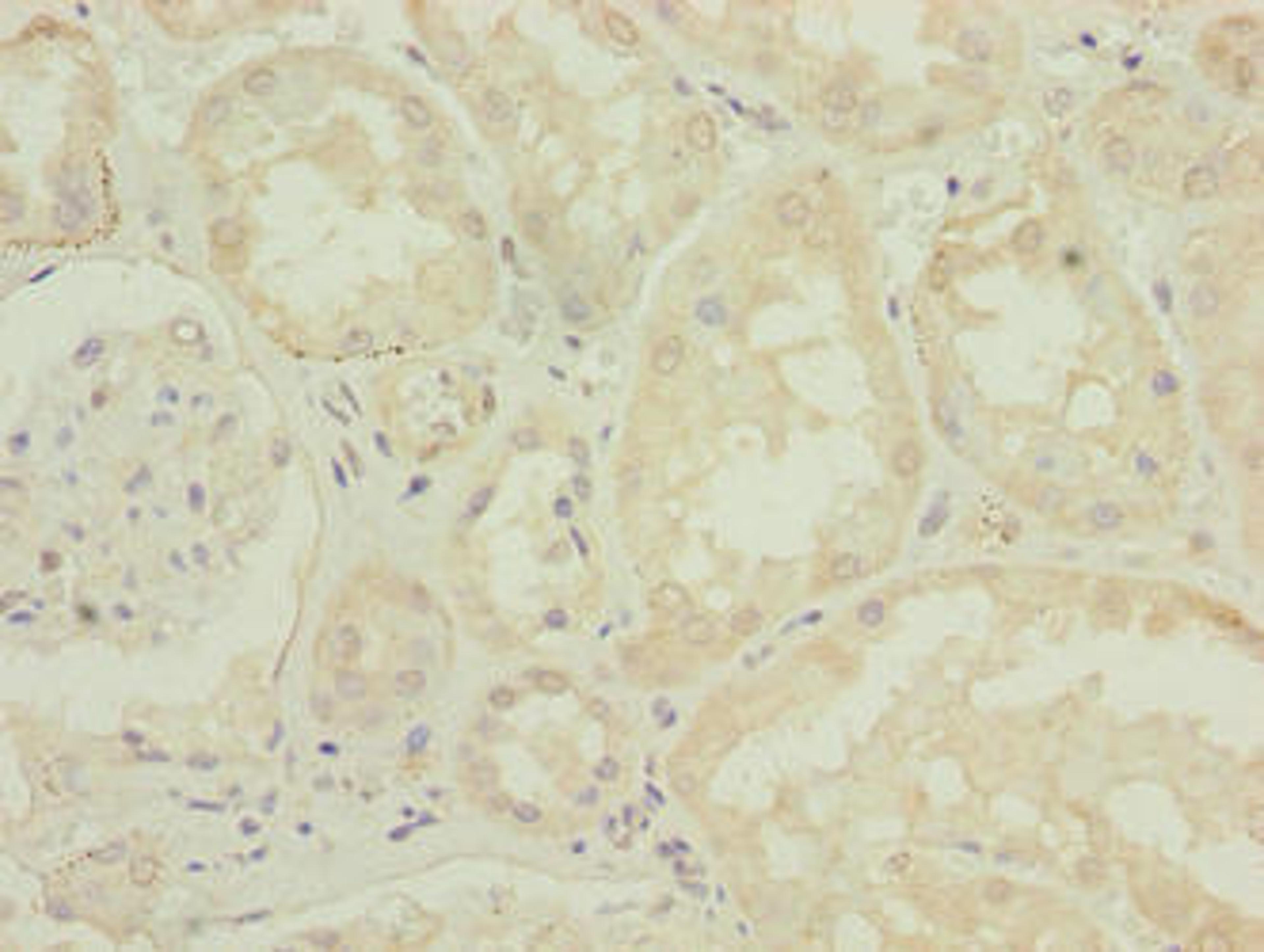 Immunohistochemistry of paraffin-embedded human kidney tissue using CSB-PA752102LA01HU at dilution of 1:100