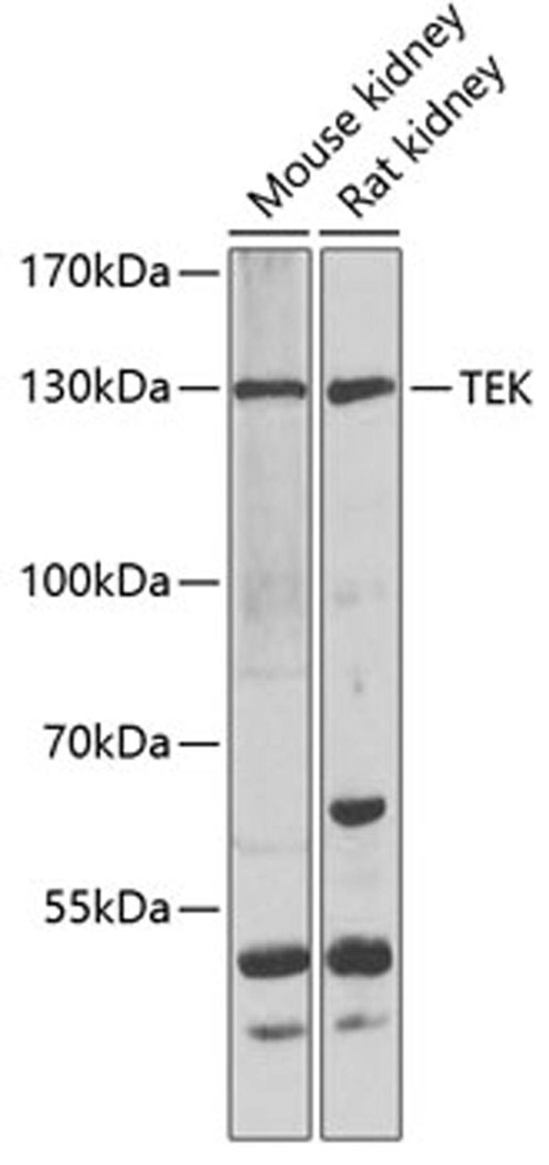 Western blot - TEK antibody (A7222)