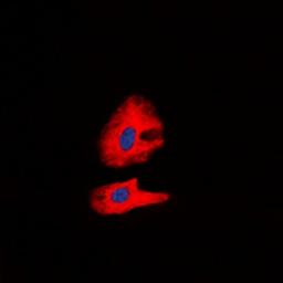 Immunofluorescense analysis of K562 cells using RET (phospho-Y1062) antibody