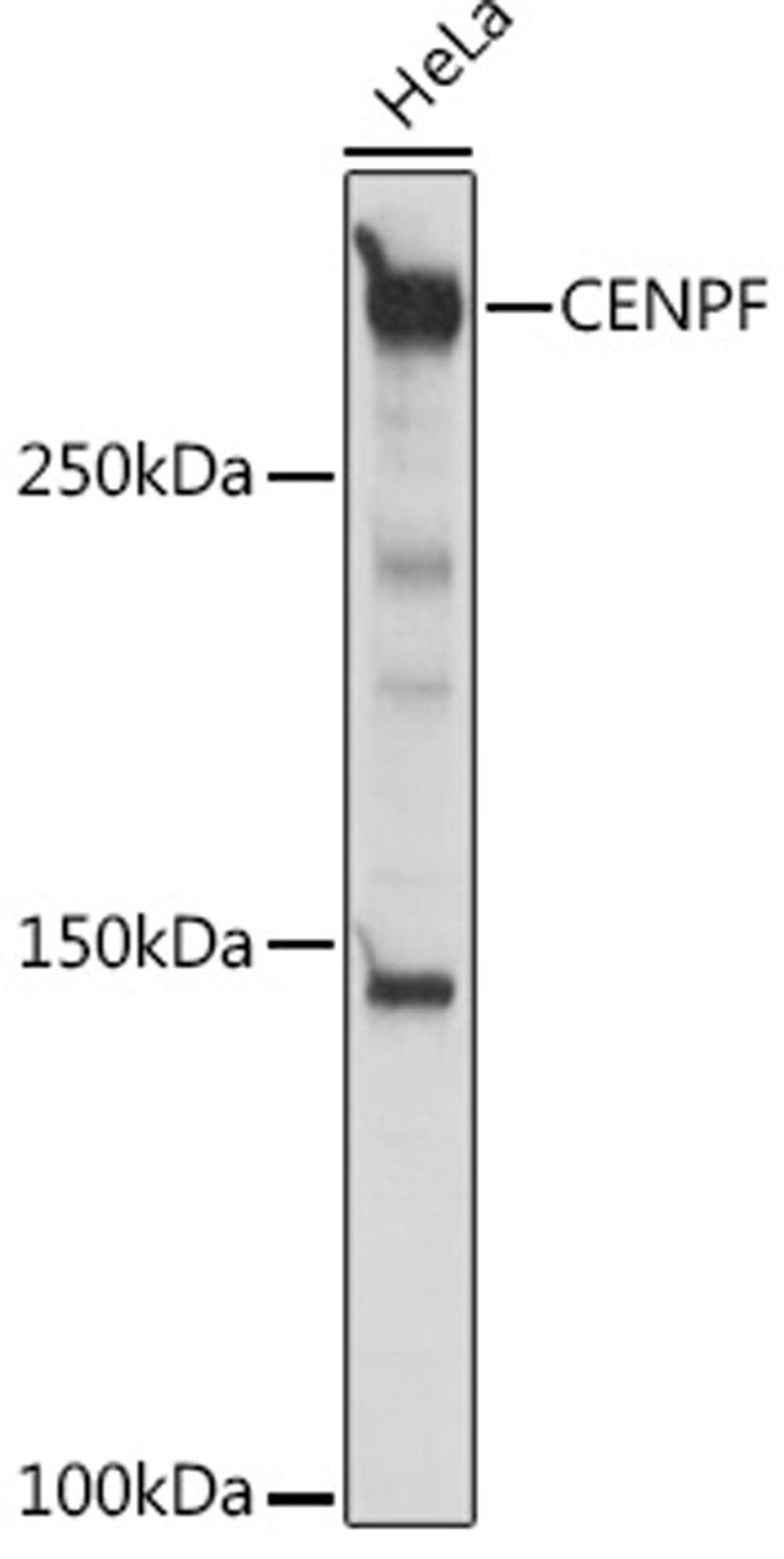 Western blot - CENPF antibody (A18644)