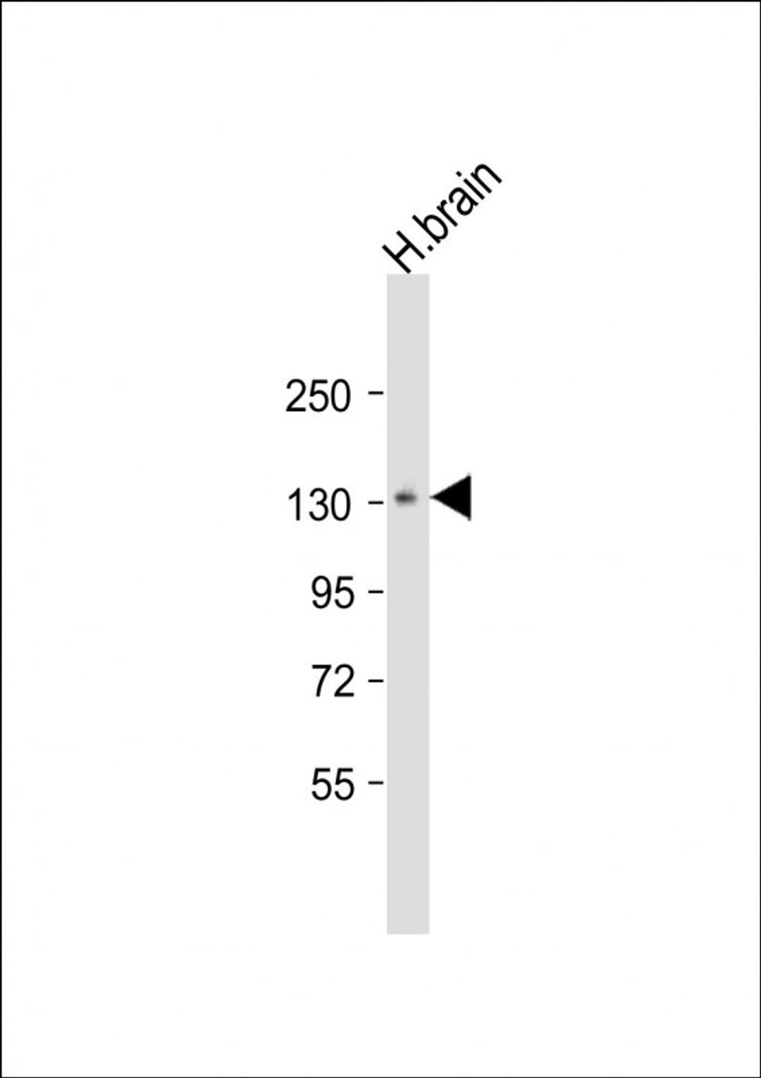 Western Blot at 1:1000 dilution + human brain lysate Lysates/proteins at 20 ug per lane.