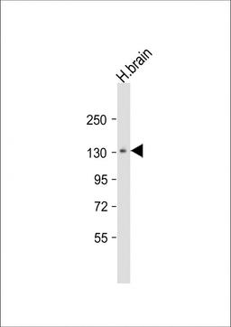 Western Blot at 1:1000 dilution + human brain lysate Lysates/proteins at 20 ug per lane.