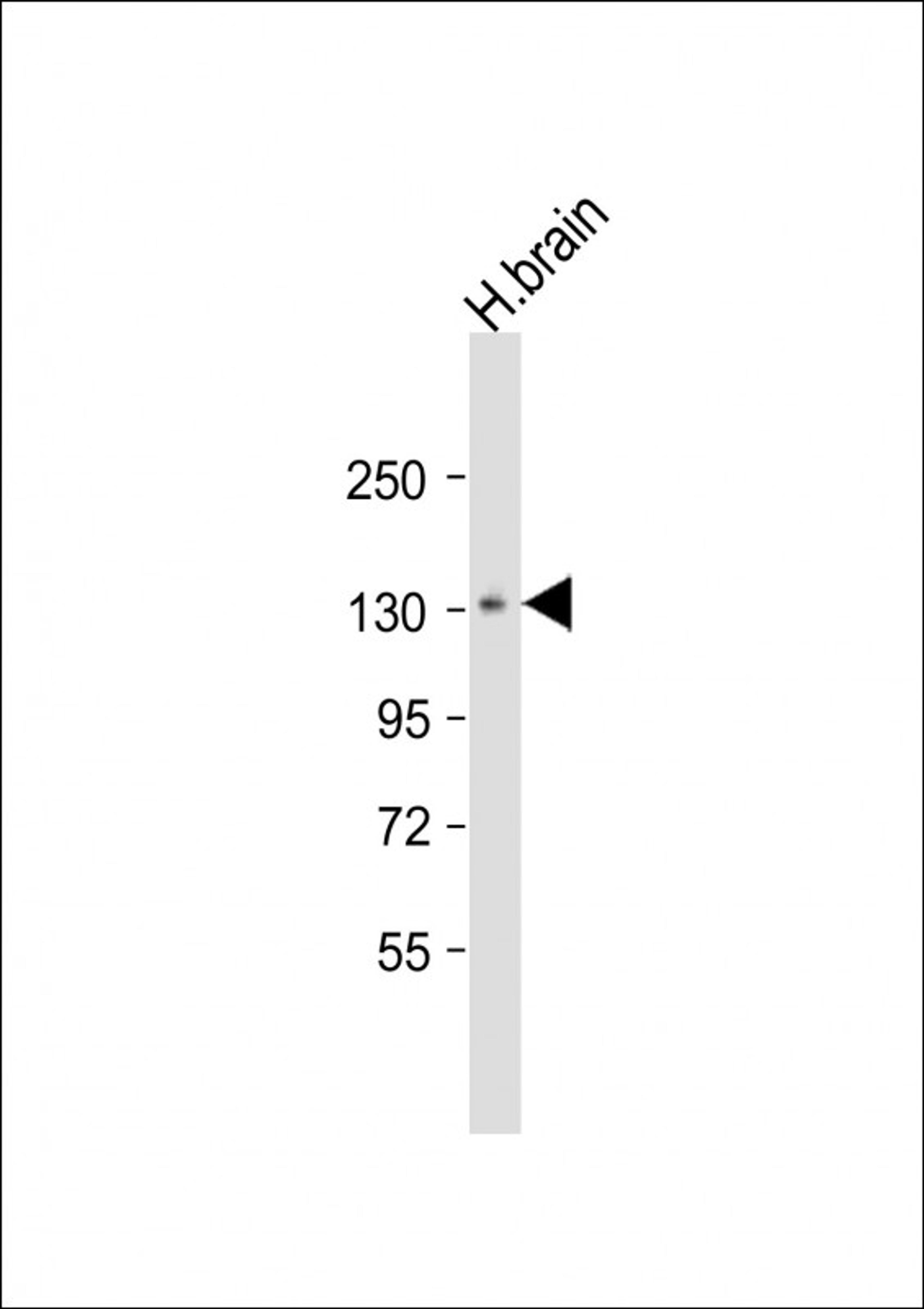 Western Blot at 1:1000 dilution + human brain lysate Lysates/proteins at 20 ug per lane.