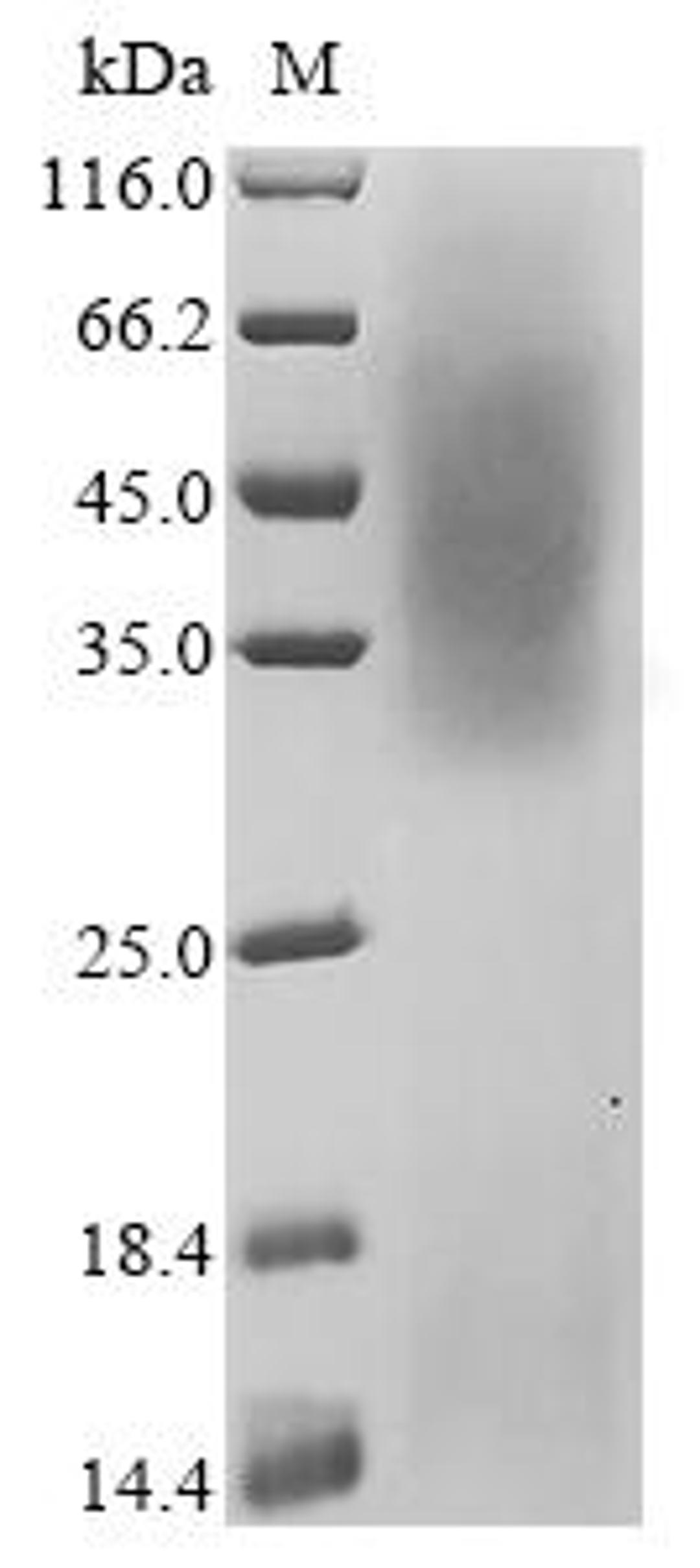 (Tris-Glycine gel) Discontinuous SDS-PAGE (reduced) with 5% enrichment gel and 15% separation gel.