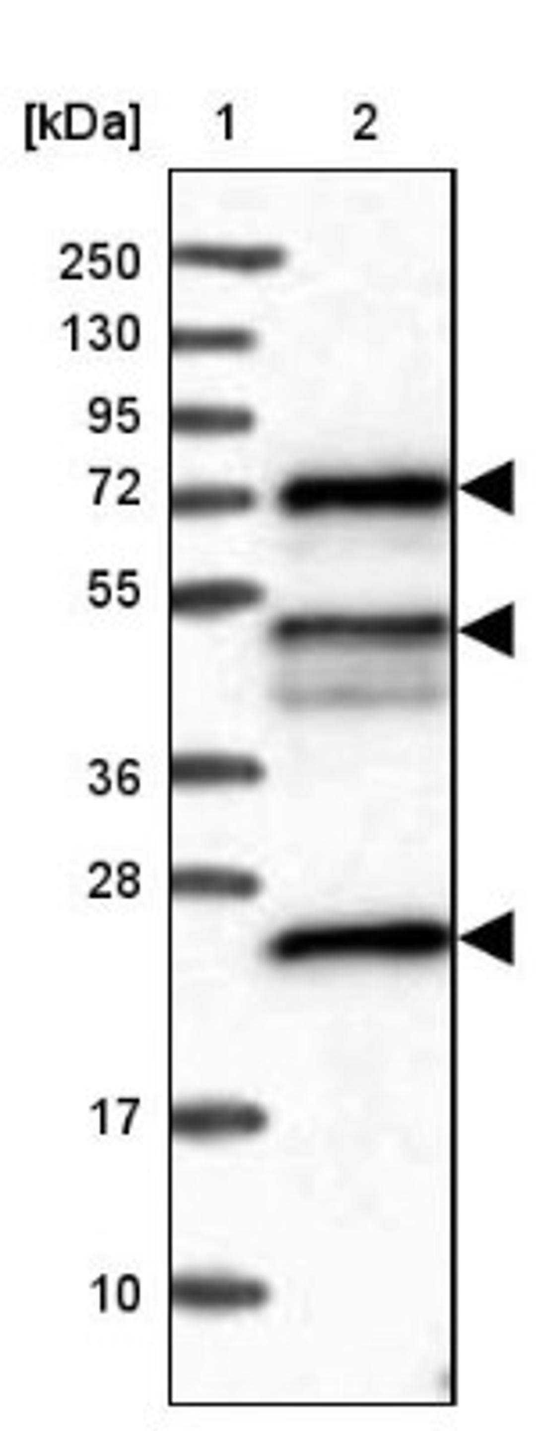 Western Blot: KANSL2 Antibody [NBP2-32637] - Lane 1: Marker [kDa] 250, 130, 95, 72, 55, 36, 28, 17, 10<br/>Lane 2: Human cell line RT-4