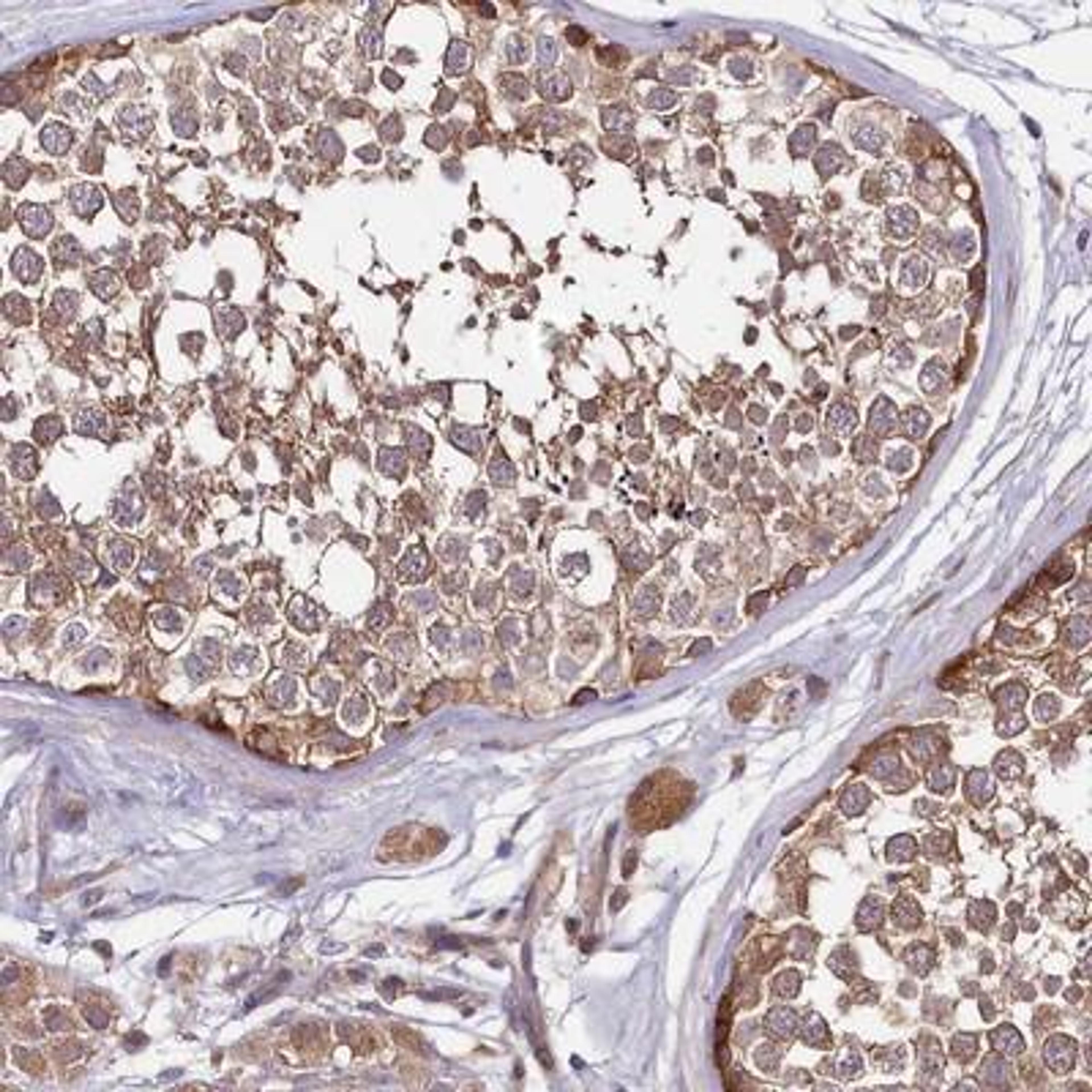 Immunohistochemistry: DMXL2 Antibody [NBP1-93618] - Staining of human testis shows moderate cytoplasmic positivity in seminiferous ducts.