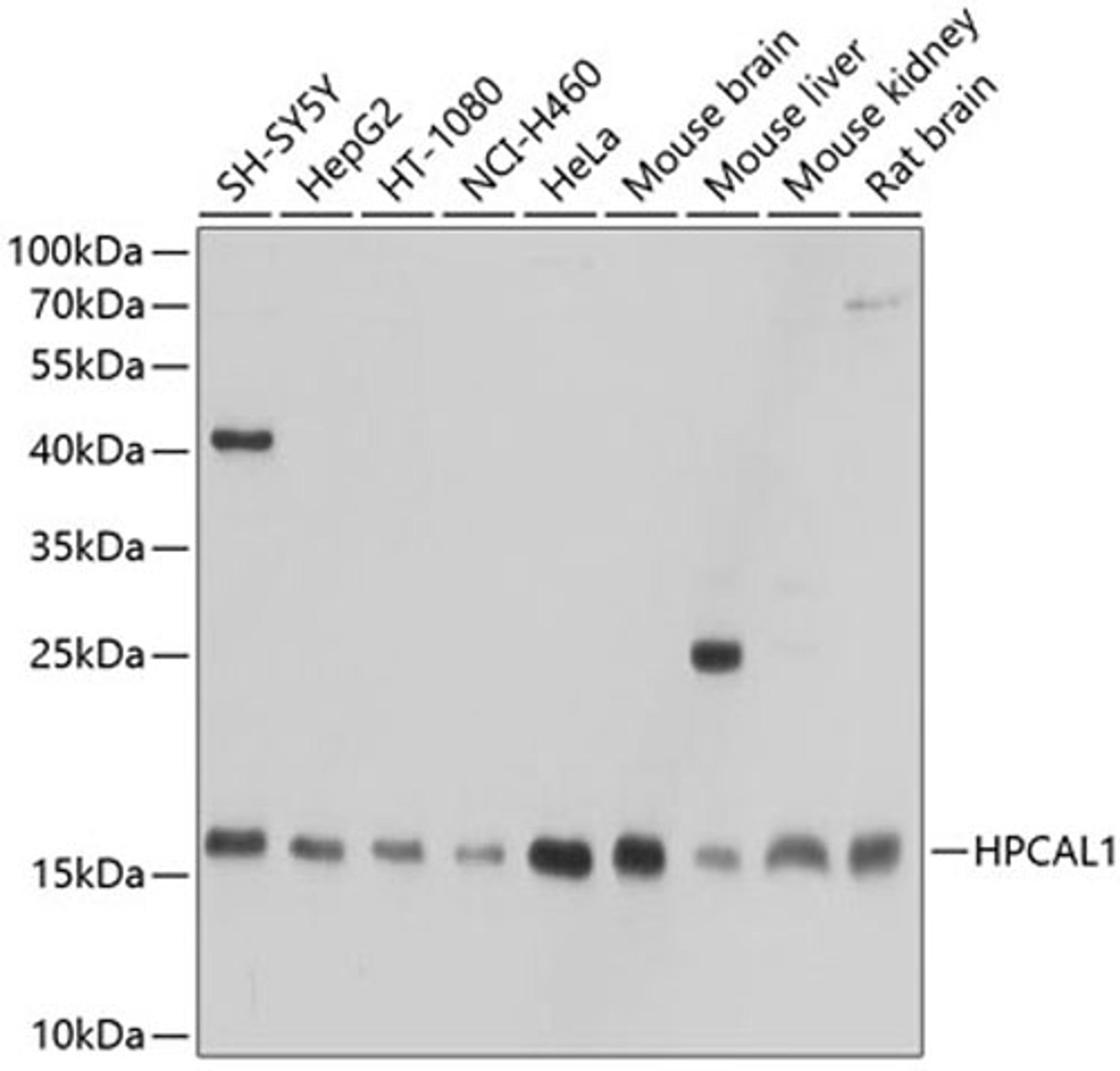 Western blot - HPCAL1 antibody (A10019)