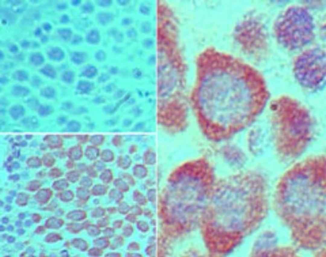 Immunohistochemistry-Paraffin: VASA Antibody [NBP2-24558] - analysis of DDX4 in formalin-fixed, paraffin-embedded mouse testis tissue using an isotype control (top left) and this antibody (bottom left, right) at 5 ug/ml.