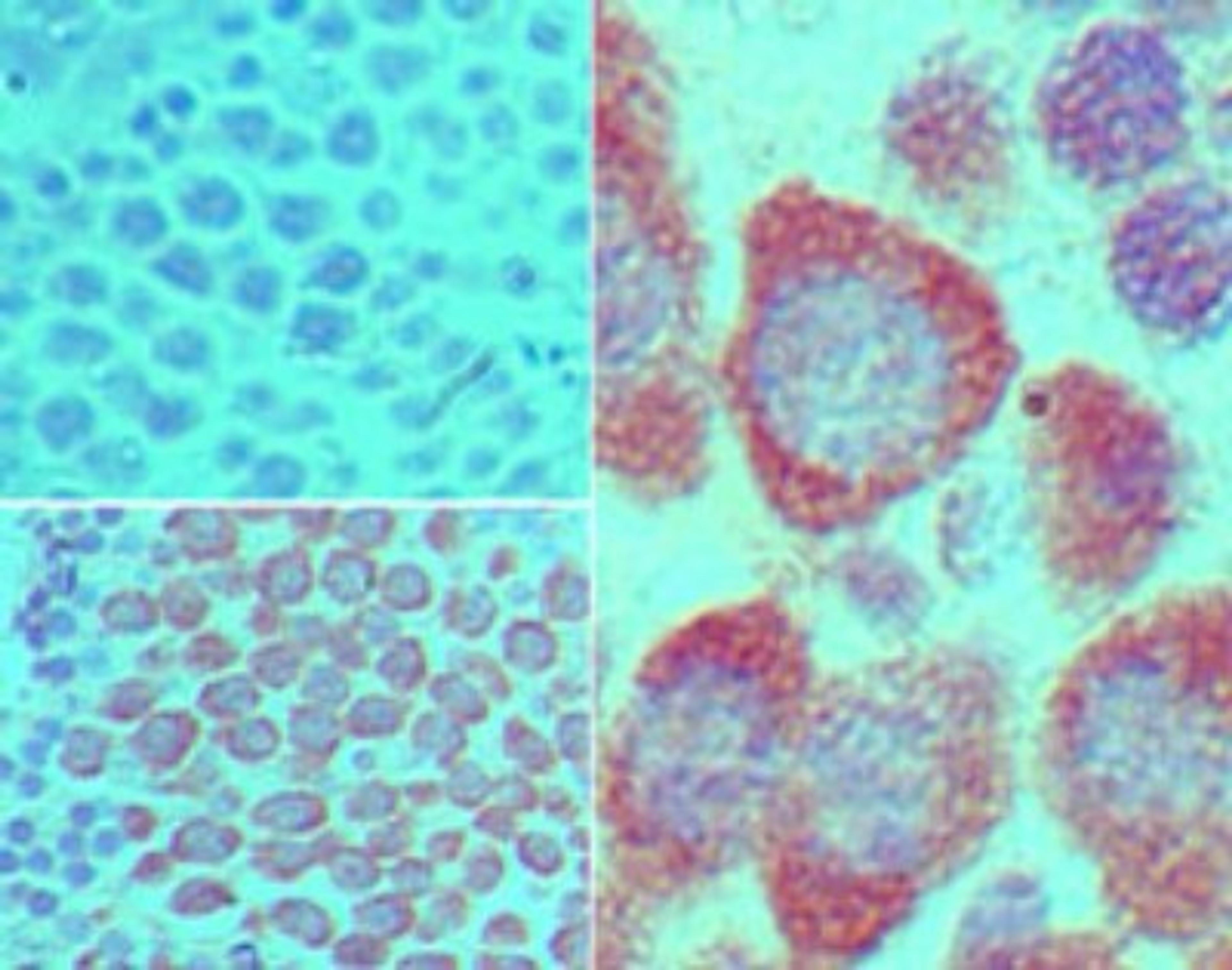 Immunohistochemistry-Paraffin: VASA Antibody [NBP2-24558] - analysis of DDX4 in formalin-fixed, paraffin-embedded mouse testis tissue using an isotype control (top left) and this antibody (bottom left, right) at 5 ug/ml.