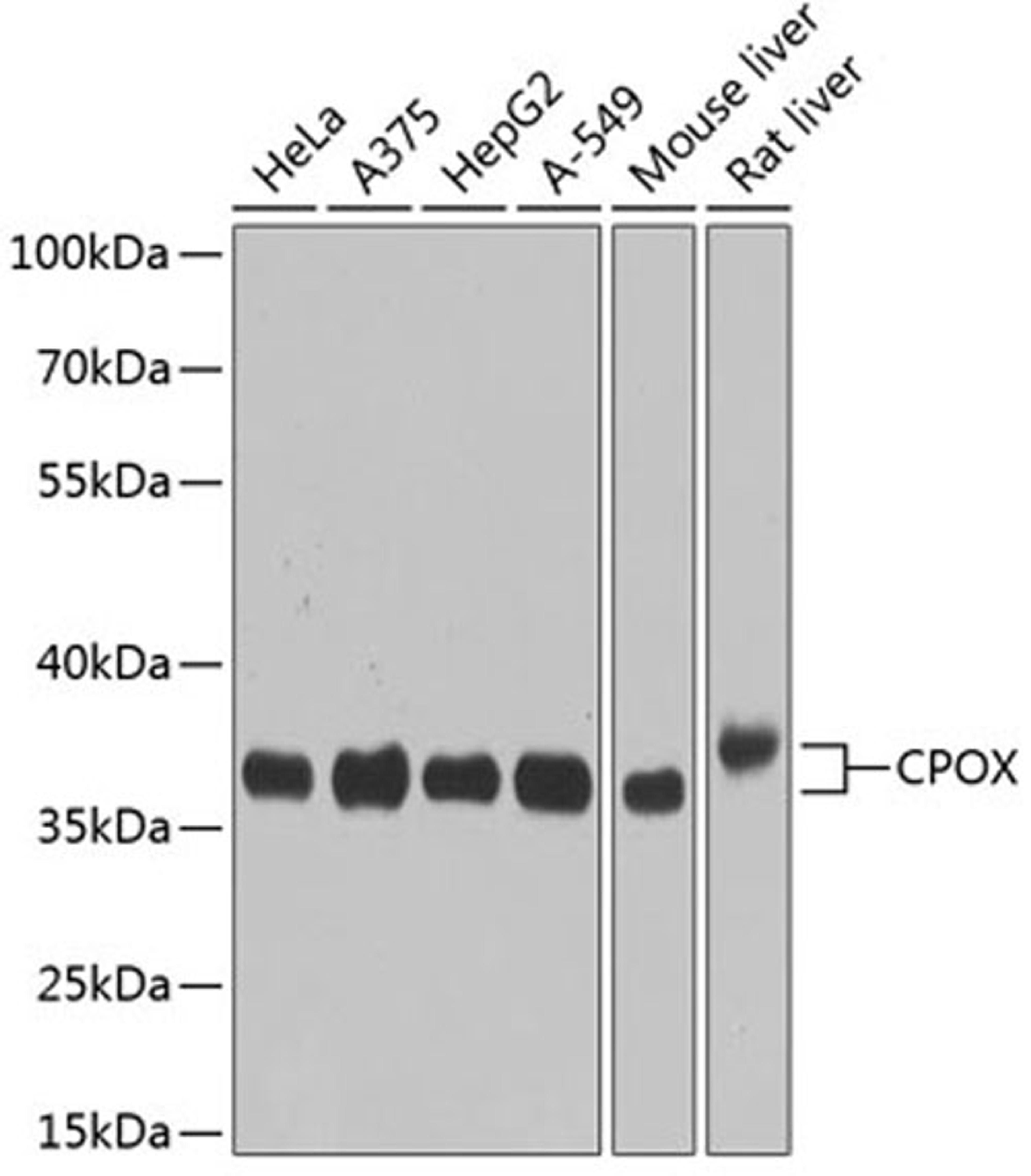 Western blot - CPOX antibody (A3807)