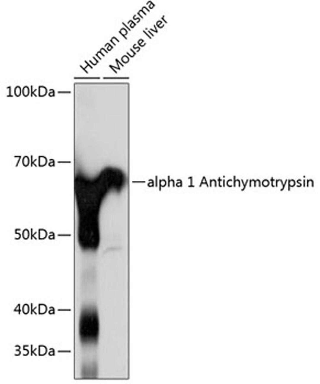 Western blot - alpha 1 Antichymotrypsin Rabbit mAb (A11364)