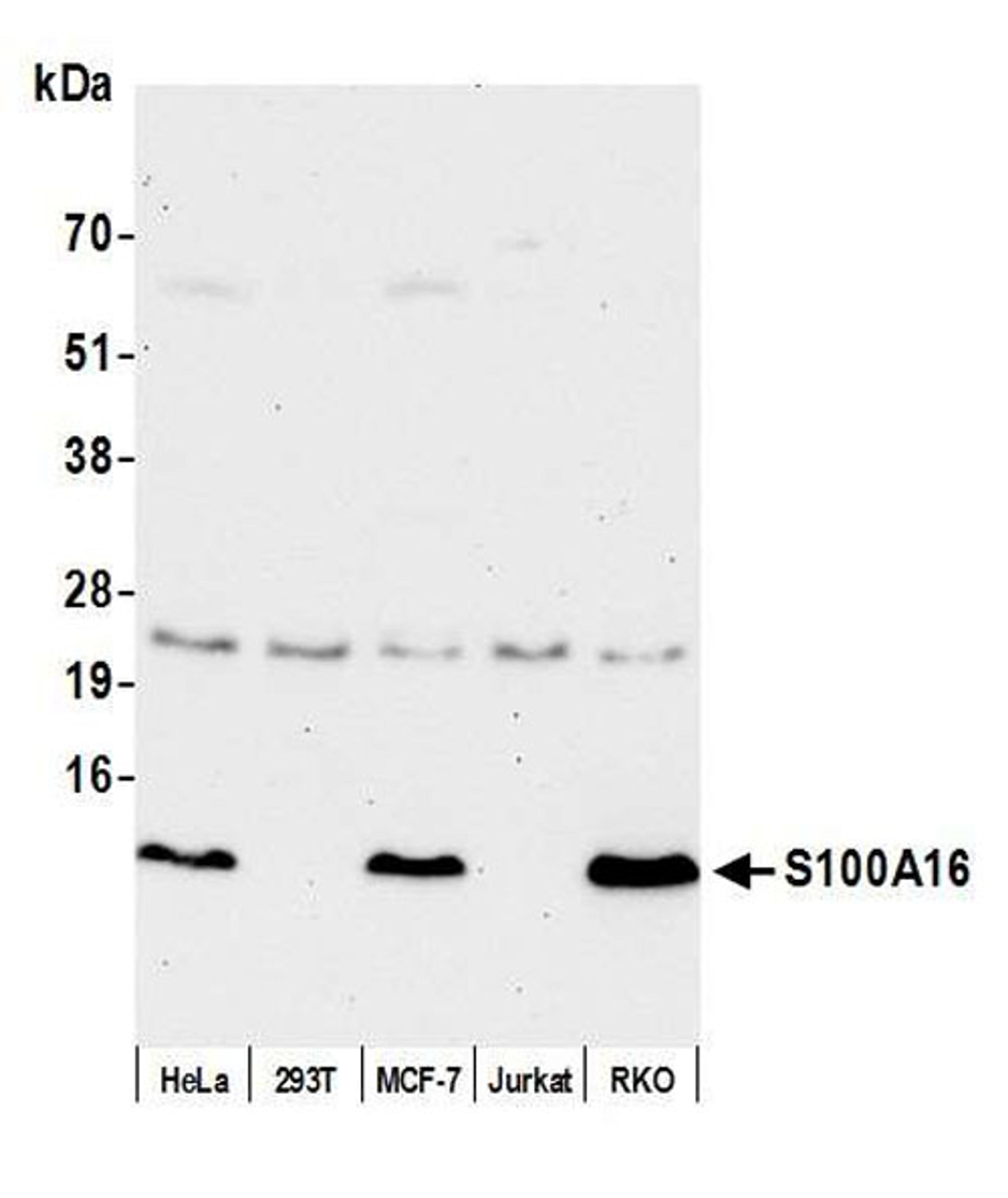 Detection of human S100A16 by WB.