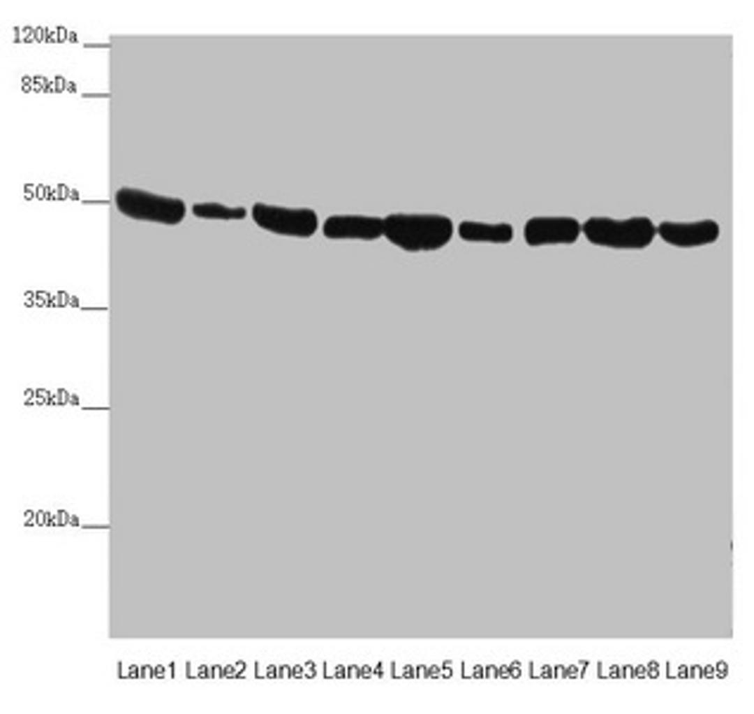 Western blot. All lanes: EEF1G antibody at 0.73µg/ml. Lane 1: Mouse gonadal tissue. Lane 2: Mouse brain tissue. Lane 3: HL60 whole cell lysate. Lane 4: NIH/3T3 whole cell lysate. Lane 5: PC-3 whole cell lysate. Lane 6: HepG2 whole cell lysate. Lane 7: Hela whole cell lysate. Lane 8: 293T whole cell lysate. Lane 9: RAW264.7 whole cell lysate. Secondary. Goat polyclonal to rabbit IgG at 1/10000 dilution. Predicted band size: 51, 57 kDa. Observed band size: 51 kDa