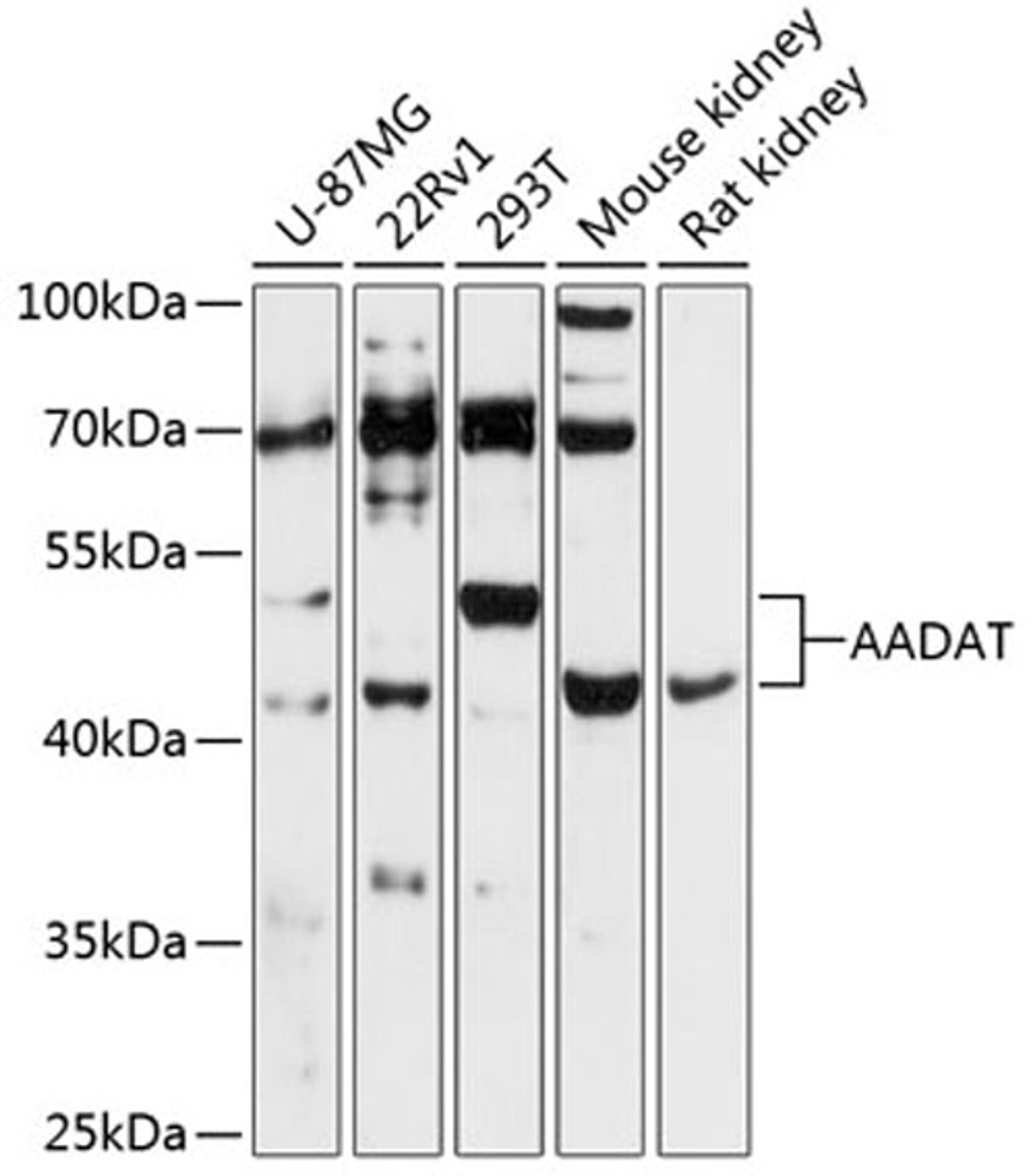 Western blot - AADAT antibody (A13089)