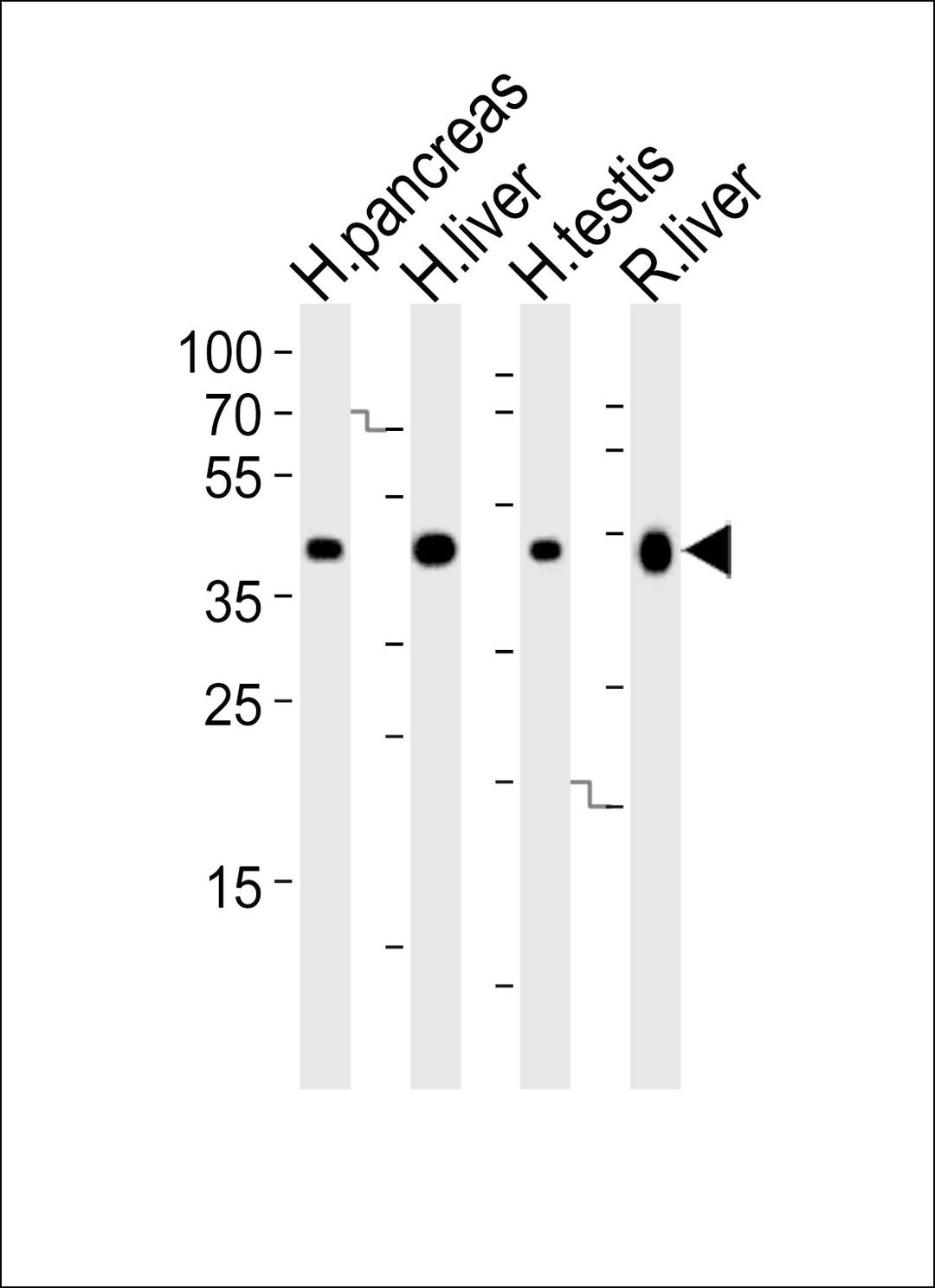 Western blot analysis of lysates from human pancreas, liver, testis and rat liver tissue lysate (from left to right), using HMGCS2 Antibody at 1:1000 at each lane.