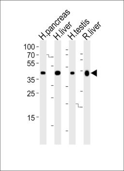 Western blot analysis of lysates from human pancreas, liver, testis and rat liver tissue lysate (from left to right), using HMGCS2 Antibody at 1:1000 at each lane.