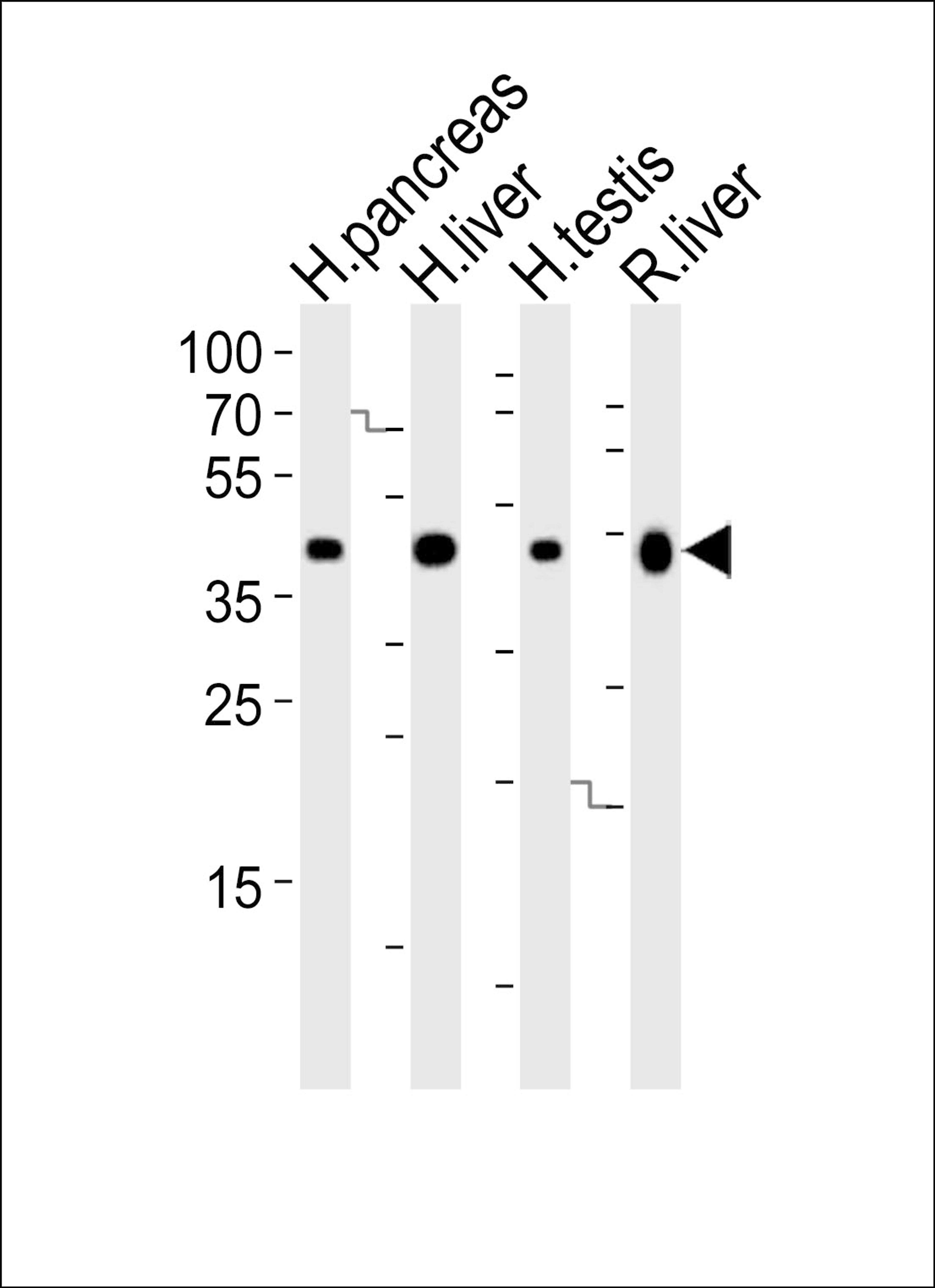 Western blot analysis of lysates from human pancreas, liver, testis and rat liver tissue lysate (from left to right), using HMGCS2 Antibody at 1:1000 at each lane.