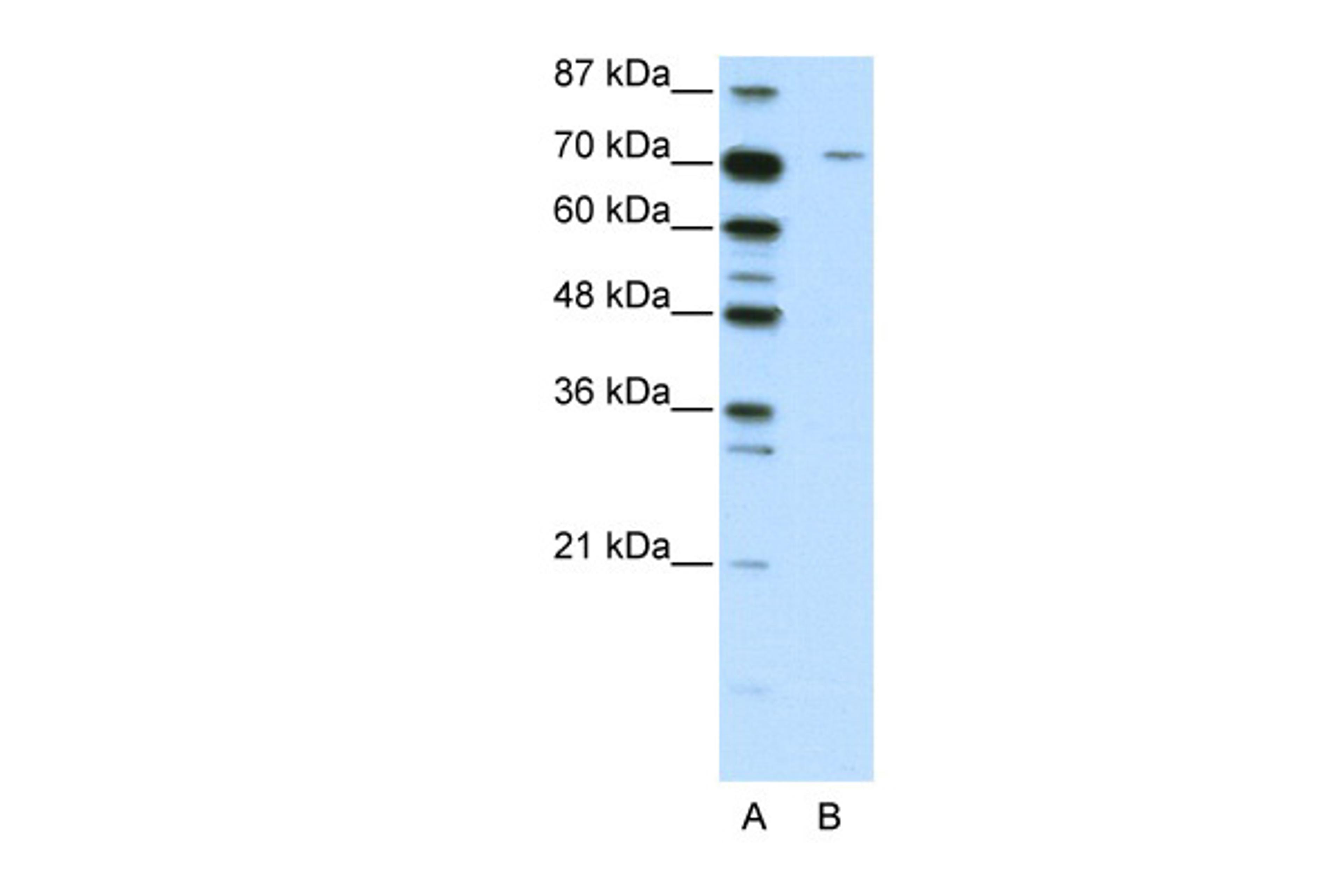 Antibody used in WB on Human Jurkat 2.5 ug/ml.