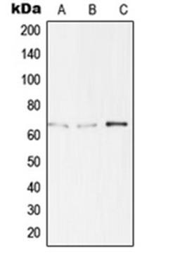 Western blot analysis of Jurkat (Lane 1), HepG2 (Lane 2), LOVO (Lane 3) whole cell lysates using TBX15 antibody