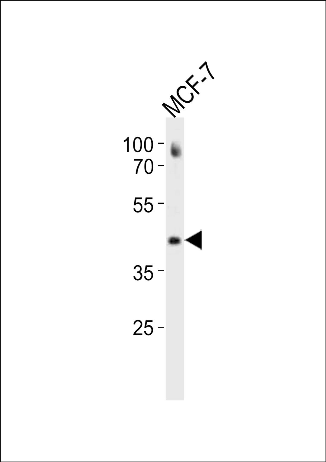 Western blot analysis in MCF-7 cell line lysates (35ug/lane).