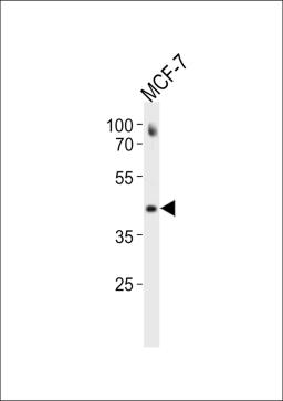 Western blot analysis in MCF-7 cell line lysates (35ug/lane).