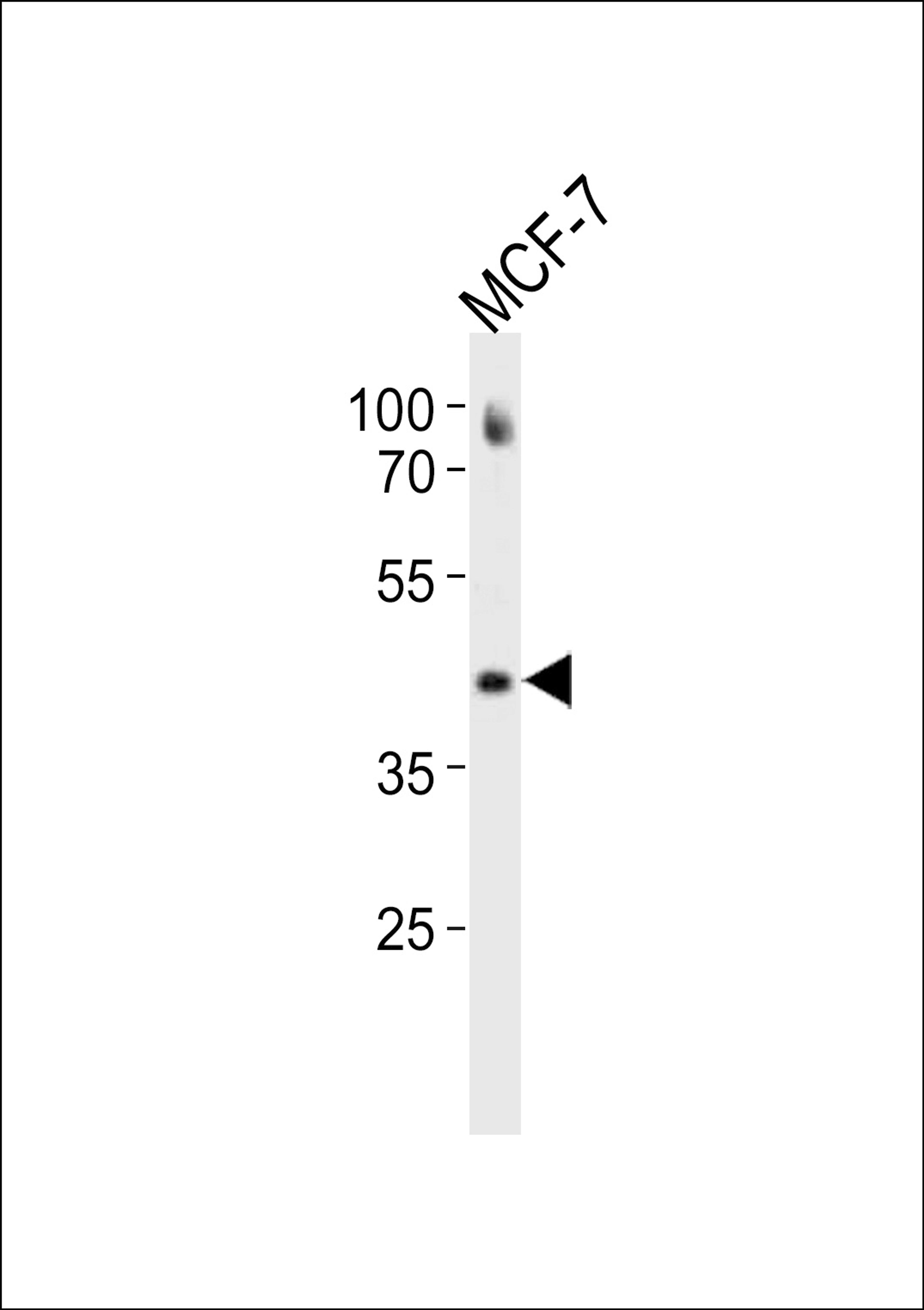 Western blot analysis in MCF-7 cell line lysates (35ug/lane).