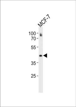 Western blot analysis in MCF-7 cell line lysates (35ug/lane).