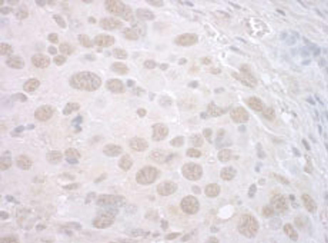 Detection of mouse CTNNBL1 by immunohistochemistry.