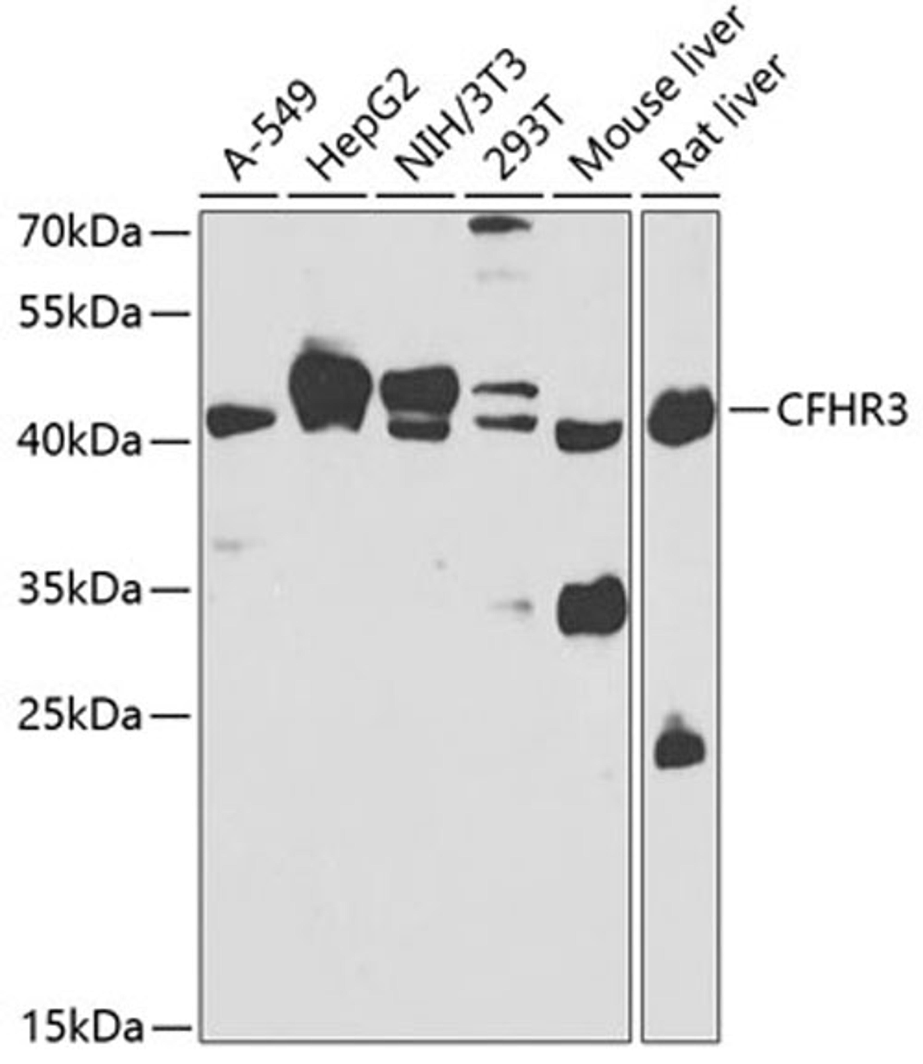 Western blot - CFHR3 antibody (A7775)