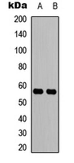 Western blot analysis of HEK293T (Lane 1), MCF7 (Lane 2) whole cell lysates using CCZ1 antibody