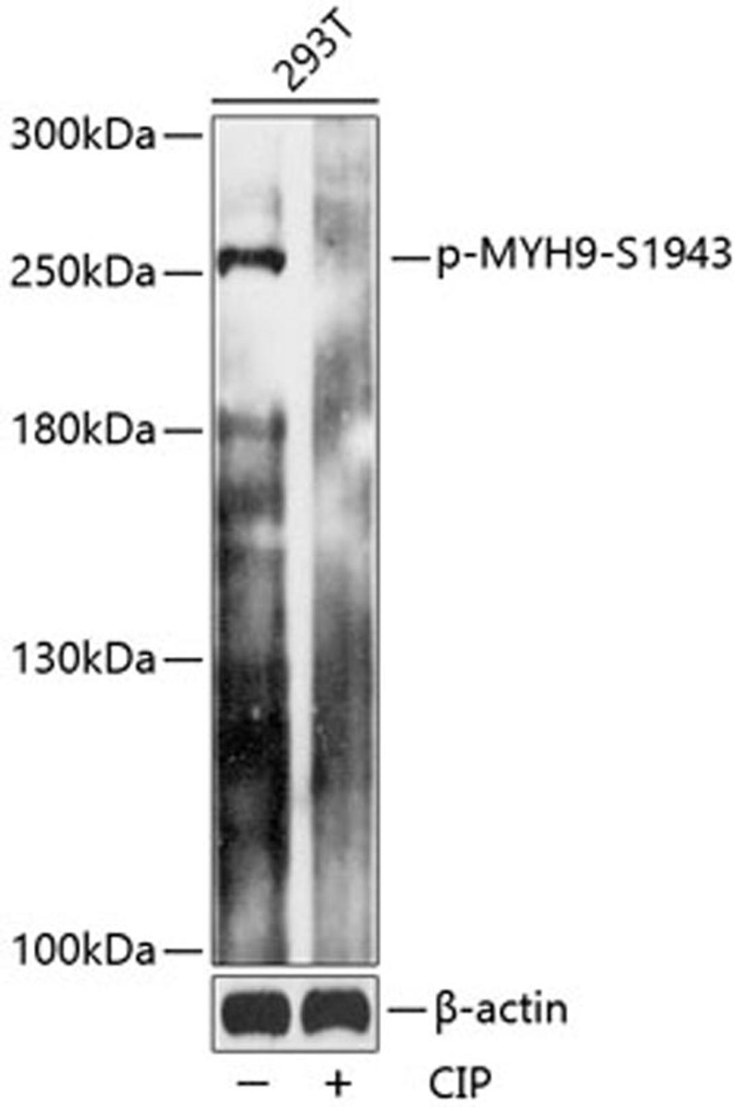 Western blot - Phospho-MYH9-S1943 antibody (AP0802)