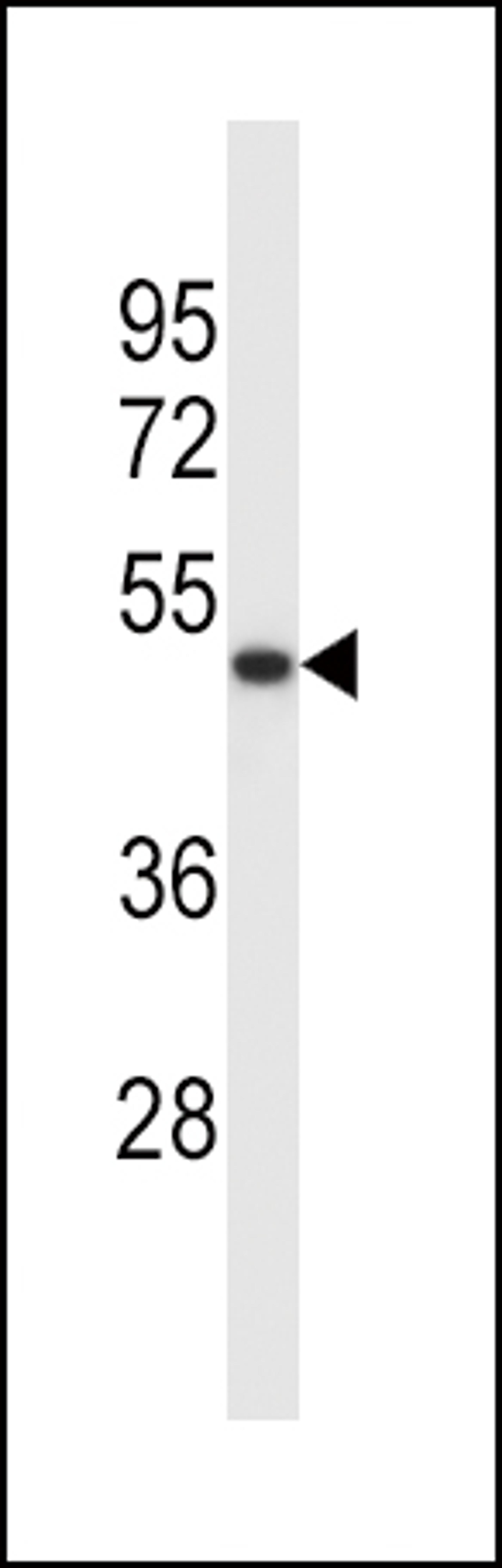 Western blot analysis in K562 cell line lysates (35ug/lane).