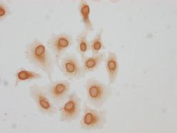 Immunocytochemistry analysis of CSB-PA010378OA51hibHU diluted at 1:25 and staining in Hela cells(treated with 30mM sodium butyrate for 4h) performed on a Leica BondTM system. The cells were fixed in 4% formaldehyde, permeabilized using 0.2% Triton X-100 and blocked with 10% normal goat serum 30min at RT. Then primary antibody (1% BSA) was incubated at 4°C overnight. The primary is detected by a biotinylated secondary antibody and visualized using an HRP conjugated SP system.
