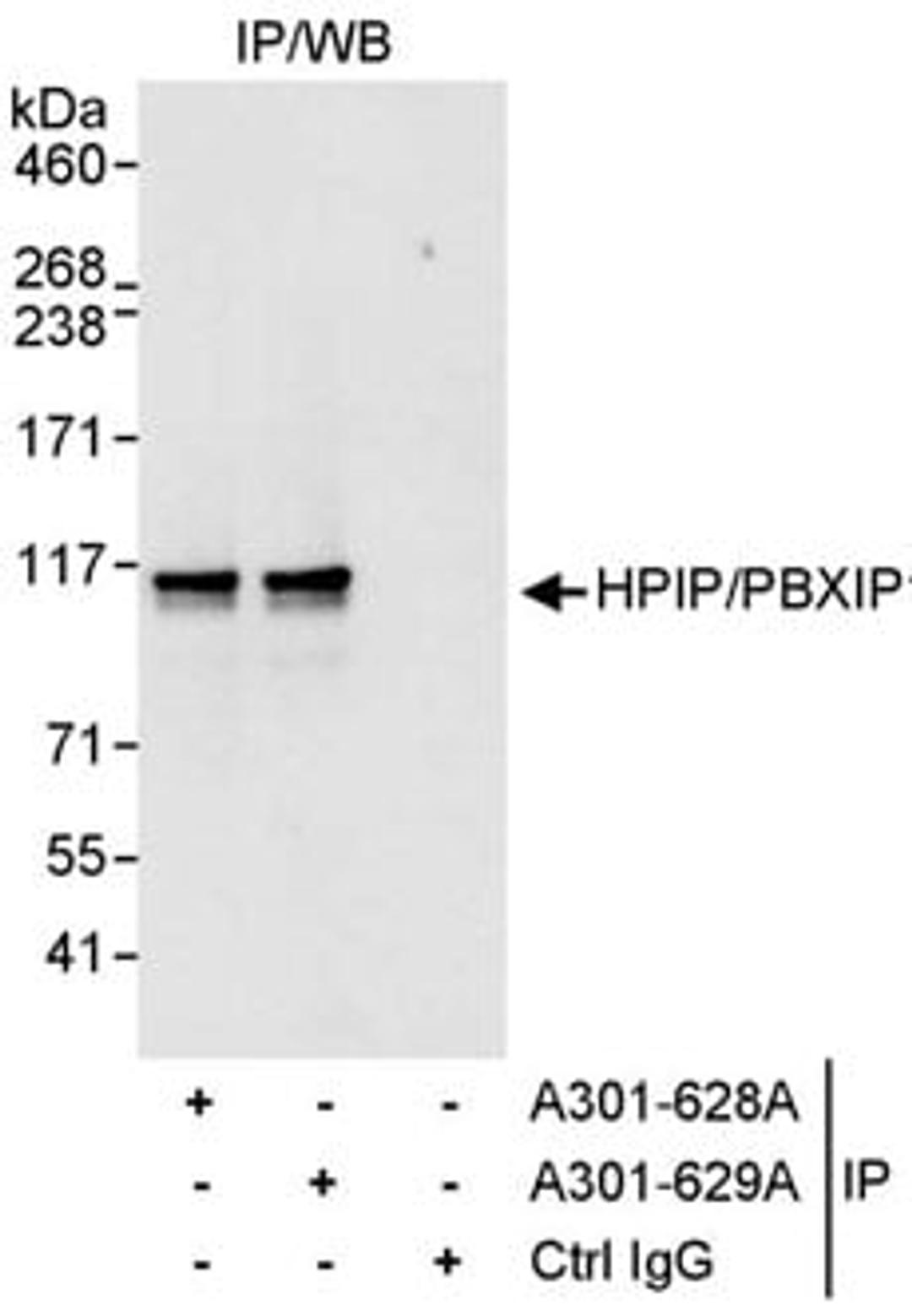 Detection of human HPIP/PBXIP1 by western blot of immunoprecipitates.