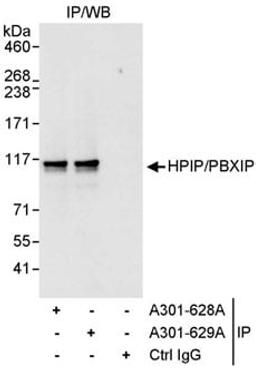 Detection of human HPIP/PBXIP1 by western blot of immunoprecipitates.