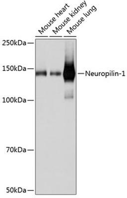 Western blot - Neuropilin-1 antibody (A19087)