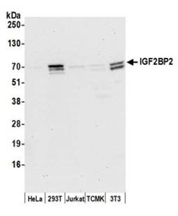 Detection of human and mouse IGF2BP2 by western blot.