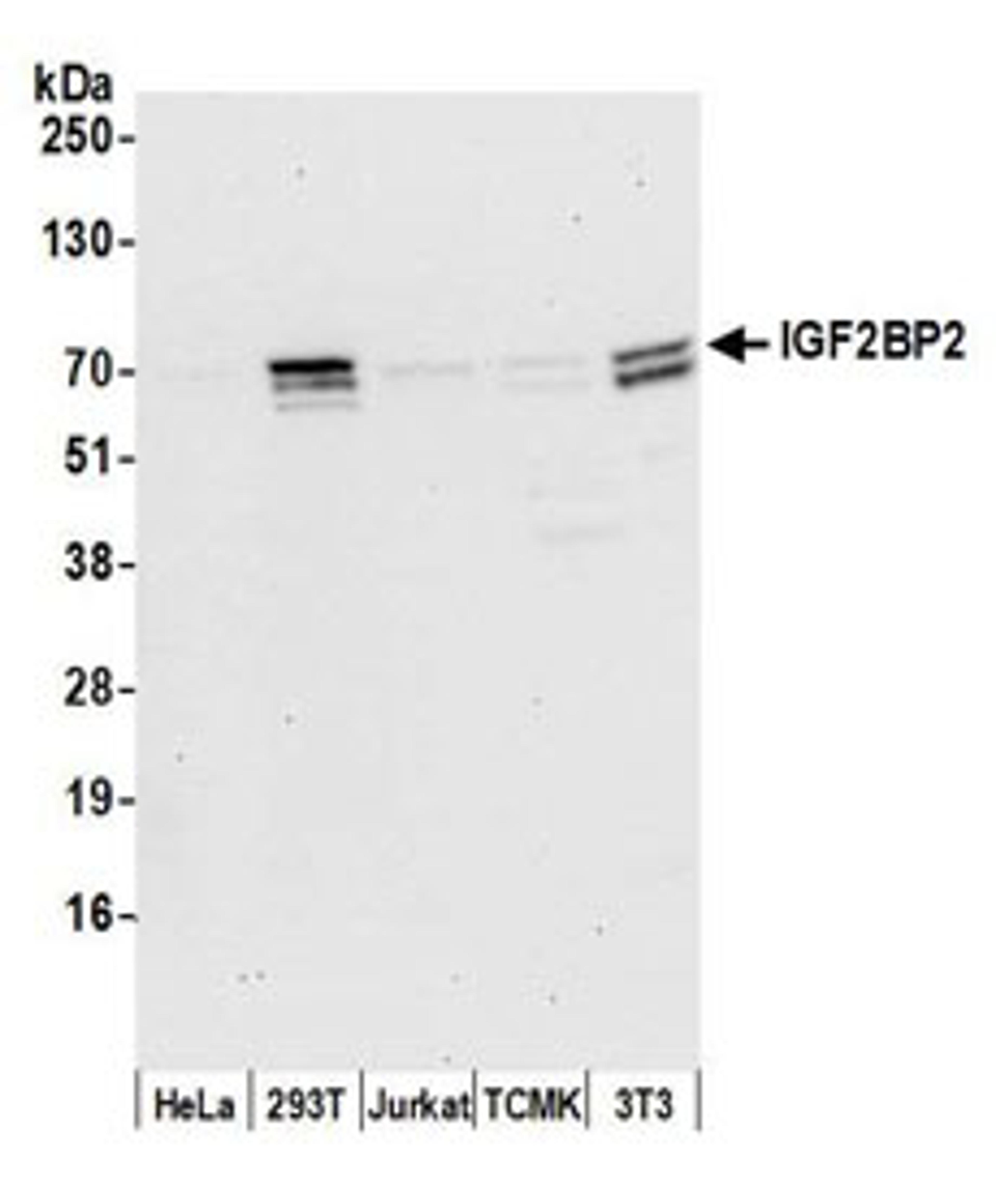 Detection of human and mouse IGF2BP2 by western blot.