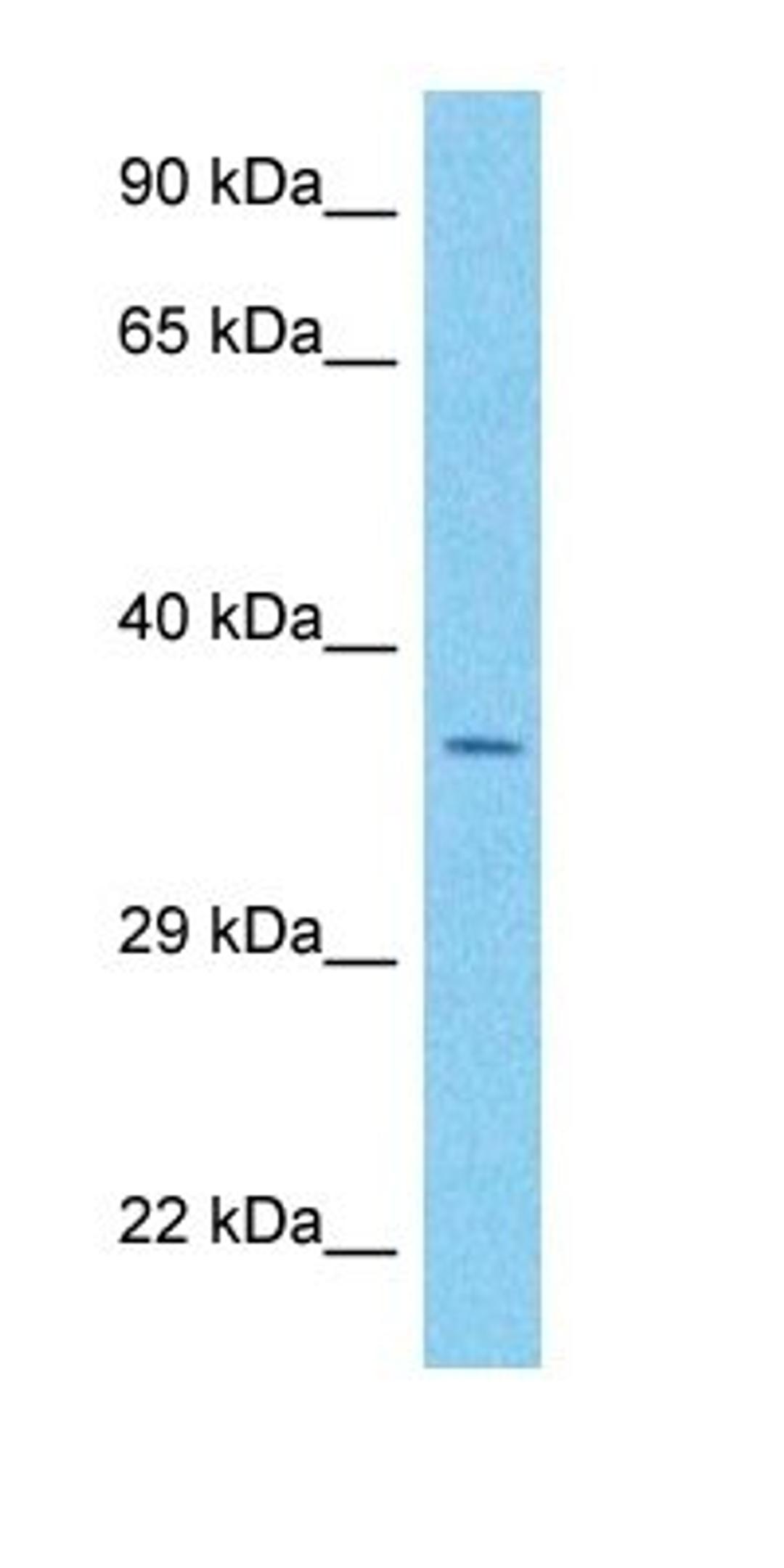 Western blot analysis of human 721_B Whole Cell tissue using SEH1 antibody