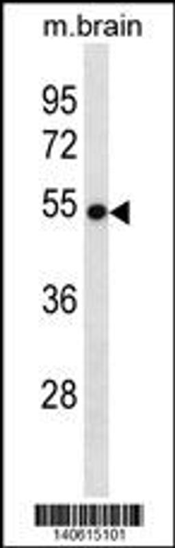 Western blot analysis in mouse brain tissue lysates (35ug/lane).