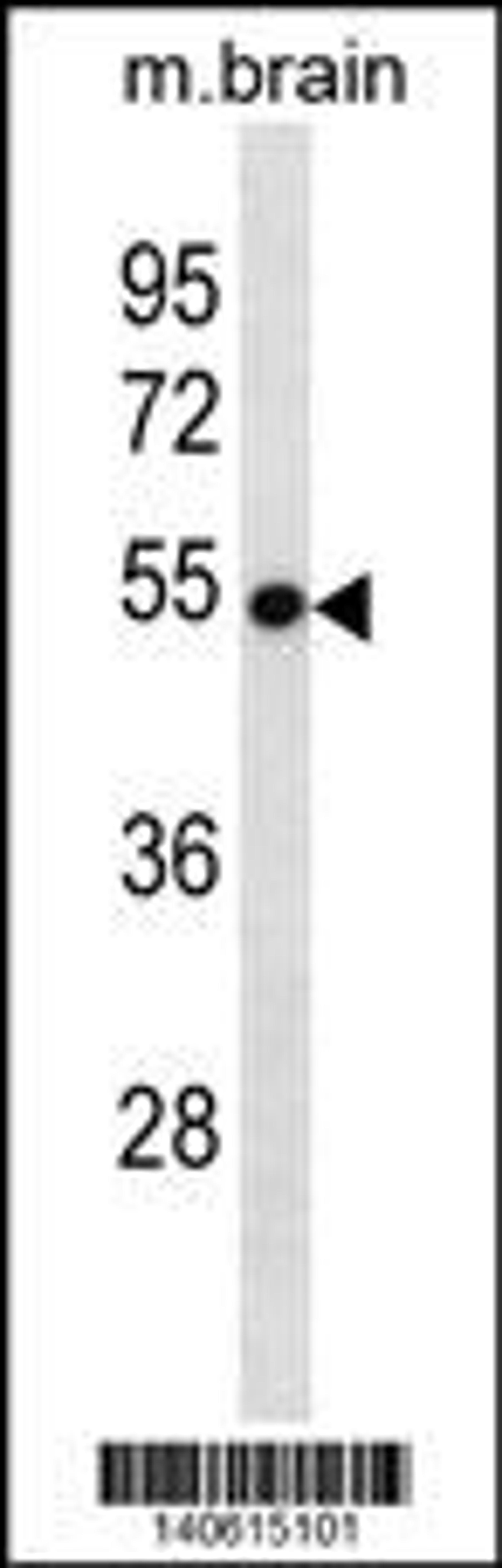 Western blot analysis in mouse brain tissue lysates (35ug/lane).